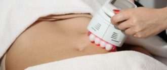 Технология «I-Lipo»