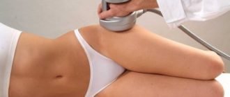 Липосакция без операции