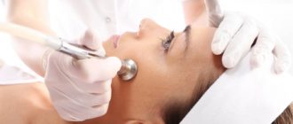 Дермабразия – механический пилинг кожи