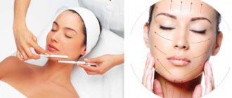 Криомассаж лица жидким азотом