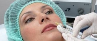 Увеличение объема губ: стоит ли делать - отзывы + фото до и после увеличения