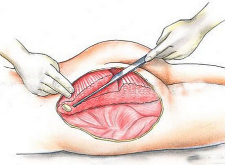 установка имплантантов