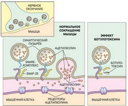 Изготавливают ботокс из яда ботулотоксина схема усвоенияя