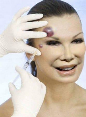 отечность лица иммунная система