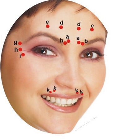 только в намеченные точки доза ботокса