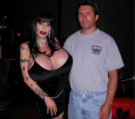 Излишки ботокса так бывает