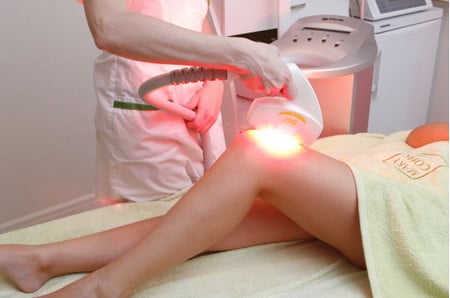 Фотоэпиляция современный метод