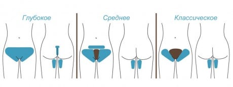как выполнять эпиляцию