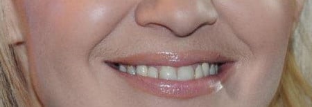 противные усики усики у женщины