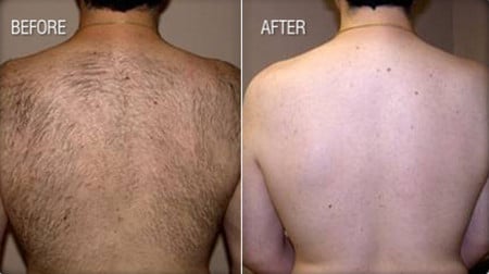 ДО и ПОСЛЕ цикла сеансов до и после