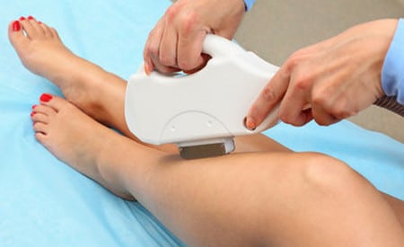 аппарат с широким охватом вспышки эпиляция ног