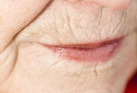 Морщинки вокруг губ никого не могут порадовать возрастные морщины