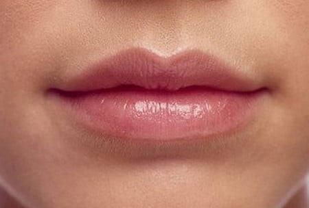 сохранение идеального контура губ ботокс в губы