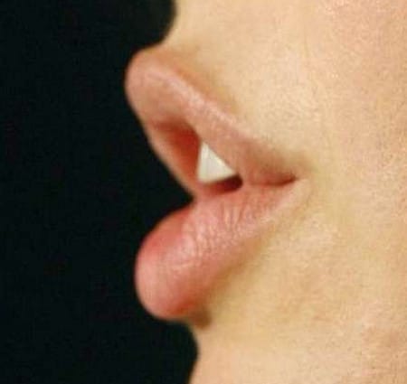 рыбка двшит гимнастика для губ