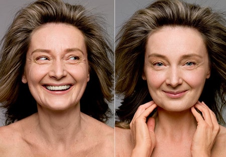 здоровье кожи