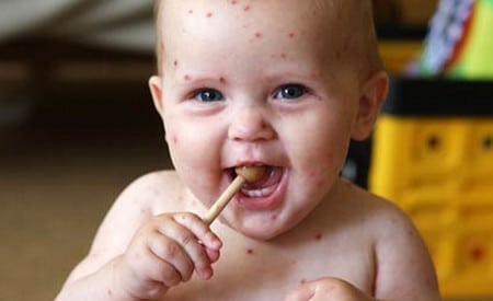 Неприглядные отметины остаются впоследствии разных травм и заболеваний откуда берутся шрамы