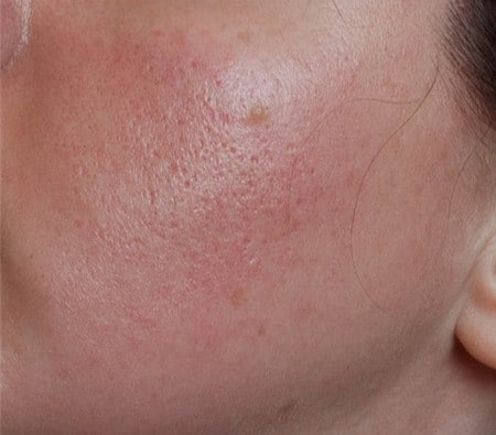 средство наносится на влажную кожу кожа