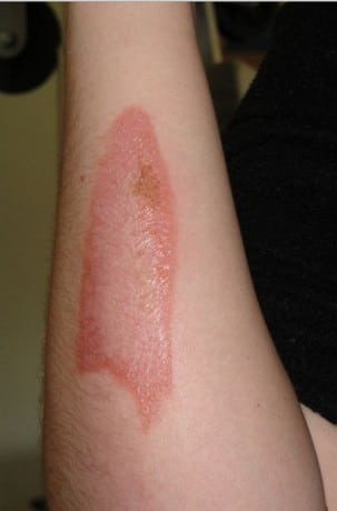 Обычная марганцовка марганцовка