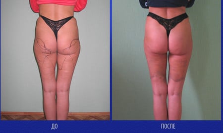 главное условие для хорошего результата условие