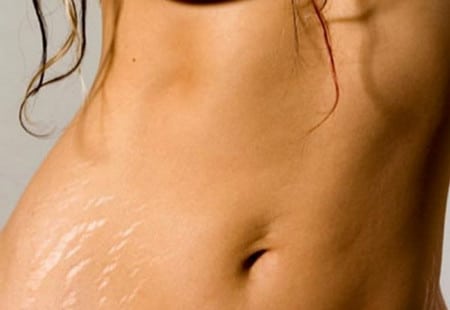 Ультразвуковая липосакция ульразвук