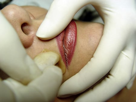 Одним из методов борьбы с дефектом является обесцвечивание волос методы борьбы