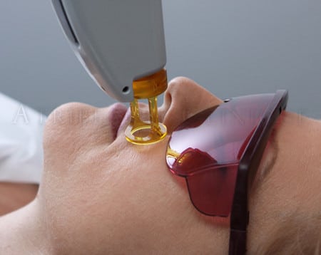 Современенный способ удаления волос современный