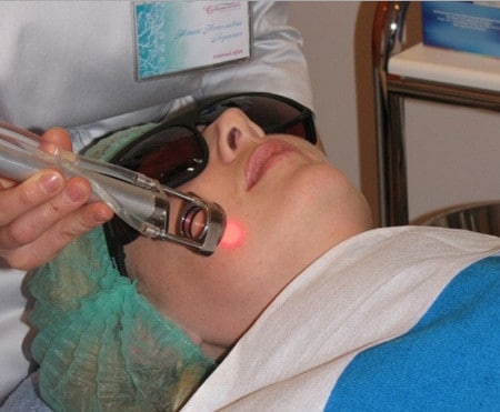 Луч лазера лазер