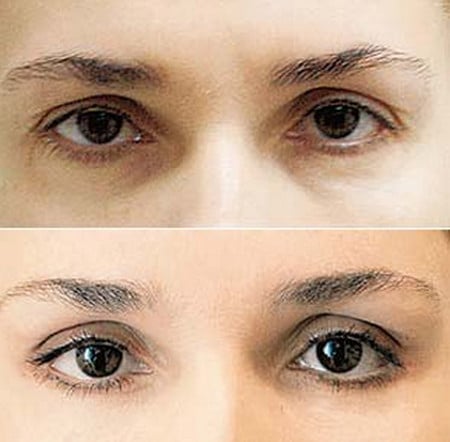 хороший результат до и после