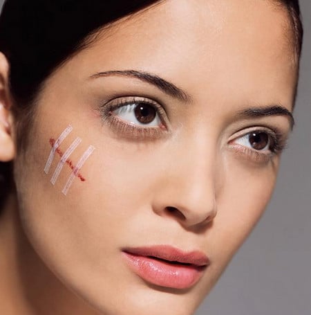 избавиться от рубцов рубцы на лице