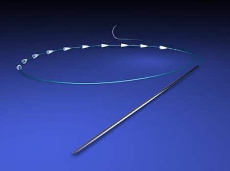 нити для подтяжки