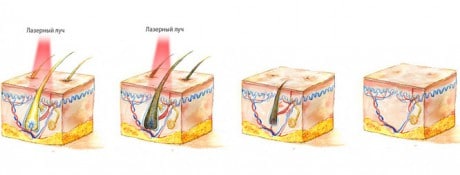 что происходит во время процедуры что происходит