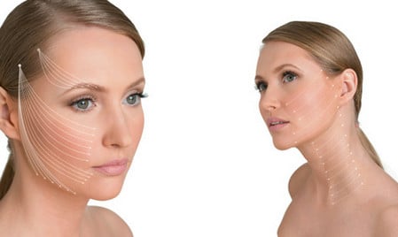 Главное в работе доктора – найти точки фиксации точки фиксации нитей