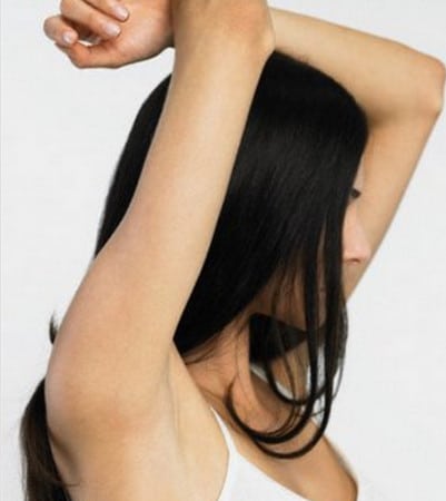 Процедура электроэпиляции