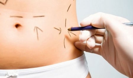 предоперационный рисунок