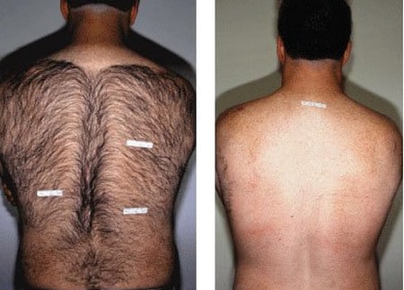 Гладкая спина спина