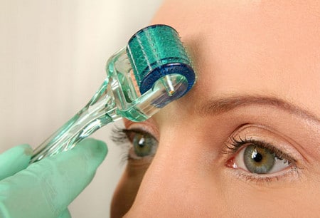 Мезороллер можно использовать на всех участках кожи мезороллер