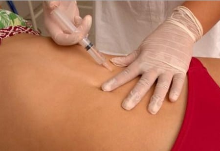 введение микродоз лечебных препаратов процедура мезотерапии