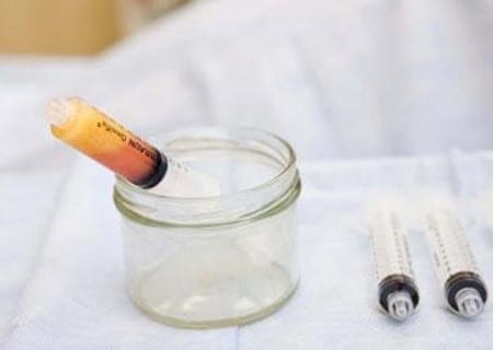 Очищенные жировые клетки перенесение жировых клеток