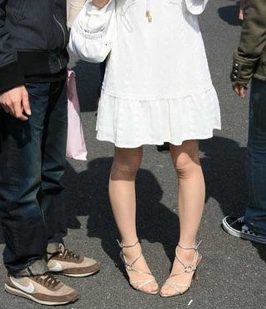 поможет липофилинг стройные ножки