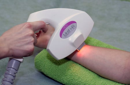 Удаление нежелательных волос волосы