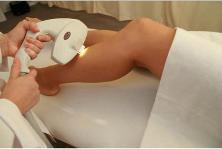 Растительность перед эпиляцией растительность