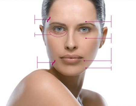 избавление от морщин