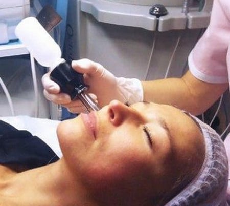 Безыгольная мезотерапия процедура