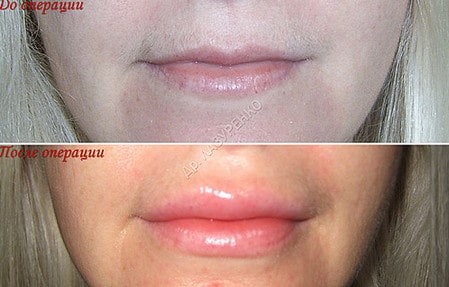 Возрастные изменения изменения