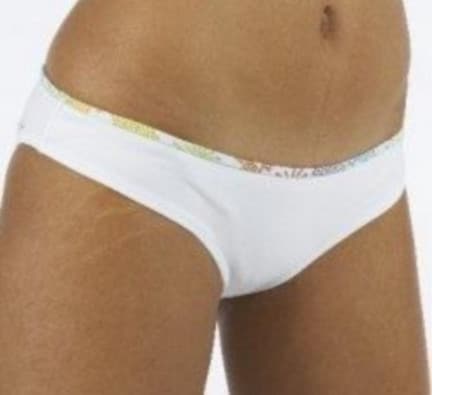 Растяжки бывают не только у женщин, склонных к полноте растяжки на теле