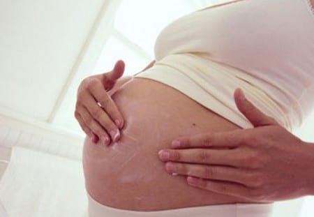 Для профилактики растяжек можно использовать специальный крем и растительное масло дефект кожи