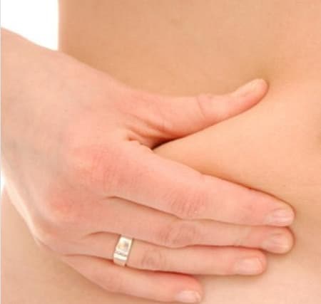 борьба со стриями