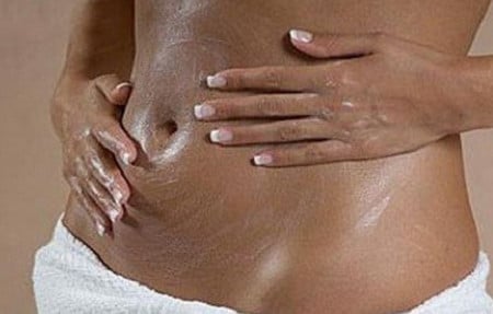 крем против стрий профилактика