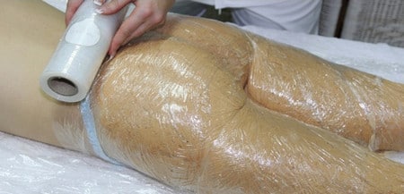 Обертывания уменьшают растяжки