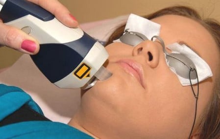 Использовать лазерную шлифовку для лечения келоидных рубцов практически во всех случаях запрещено как убрать рубцы